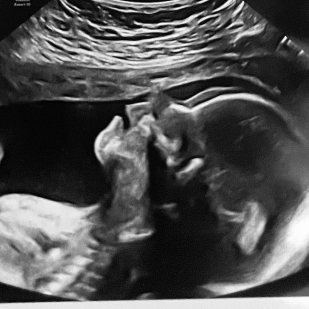 Photo shared by Gina for their Babylist baby registry.