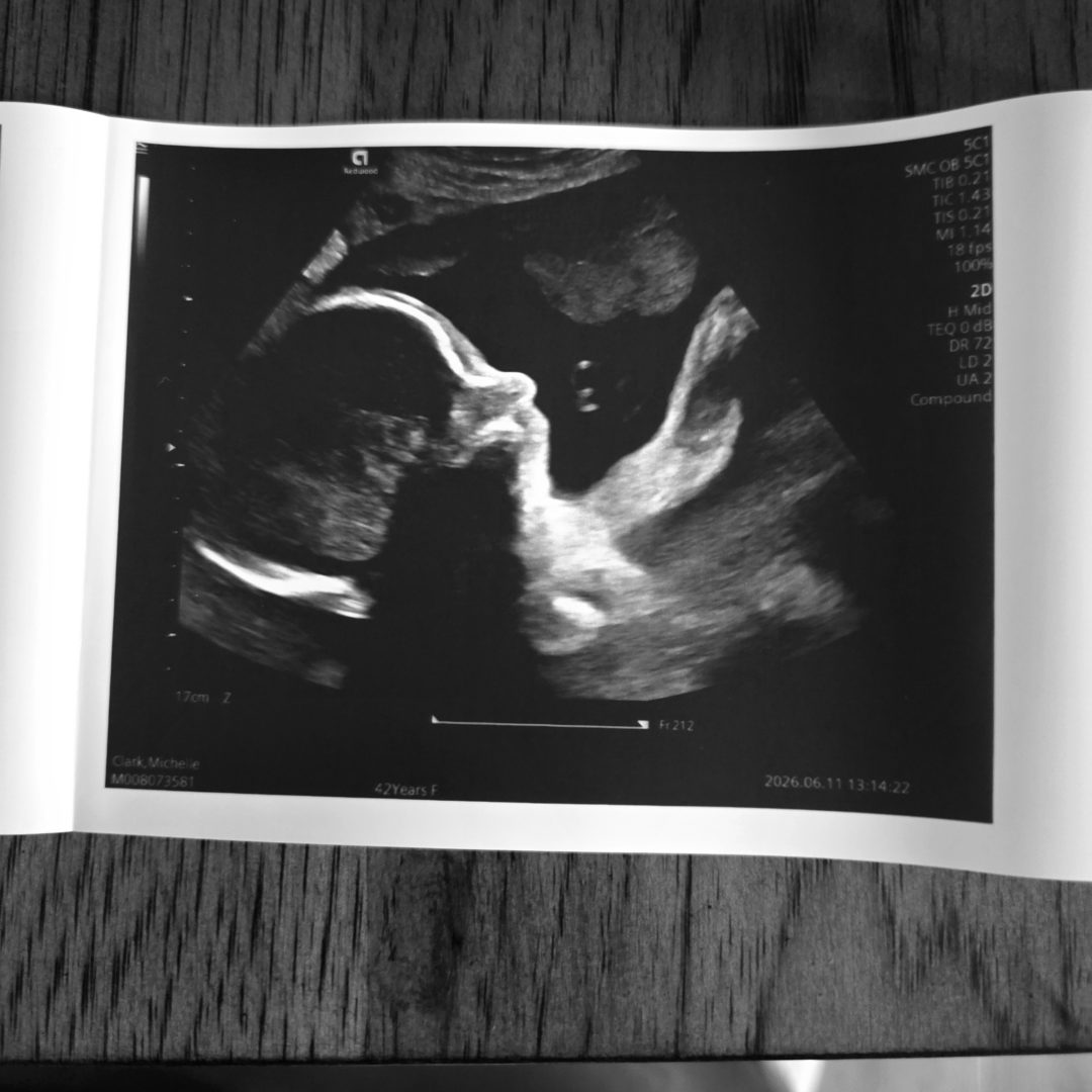 Photo shared by Michelle for their Babylist baby registry.
