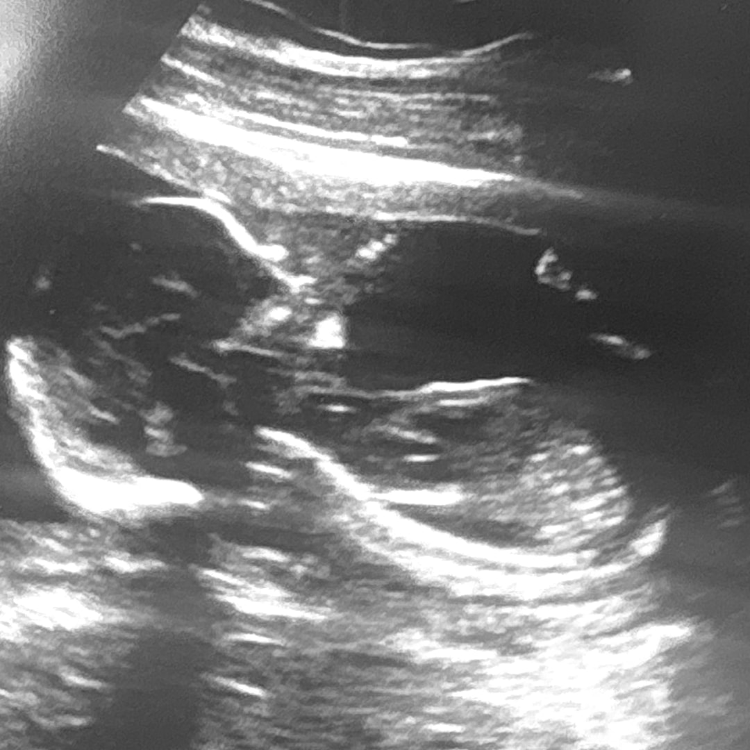 Photo shared by Dasia for their Babylist baby registry.