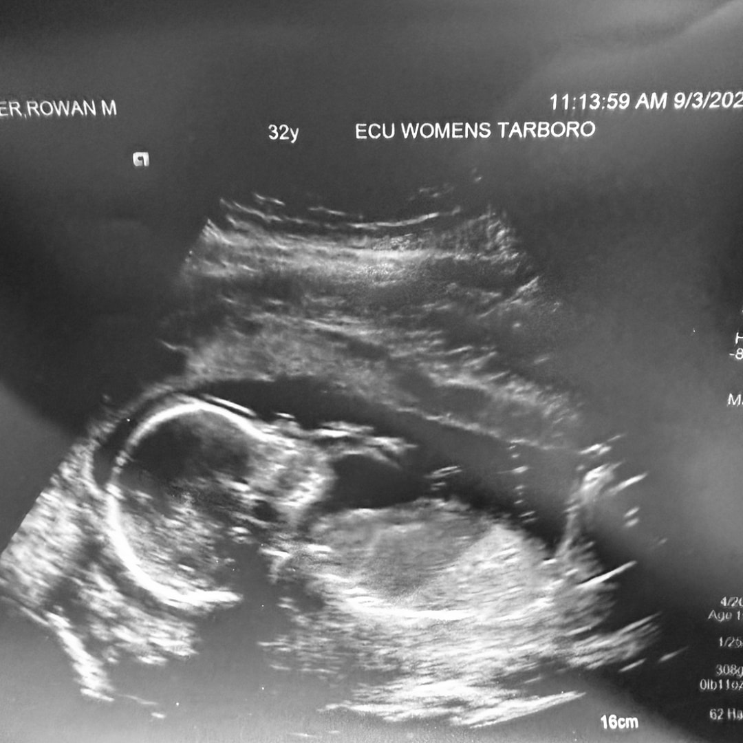 Photo shared by Rowan for their Babylist baby registry.