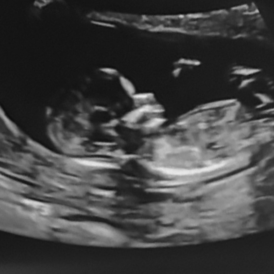 Photo shared by Taylor for their Babylist baby registry.