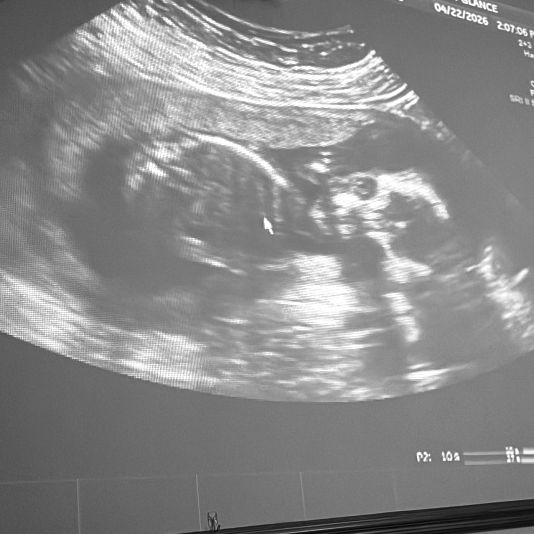 Photo shared by Haley for their Babylist baby registry.