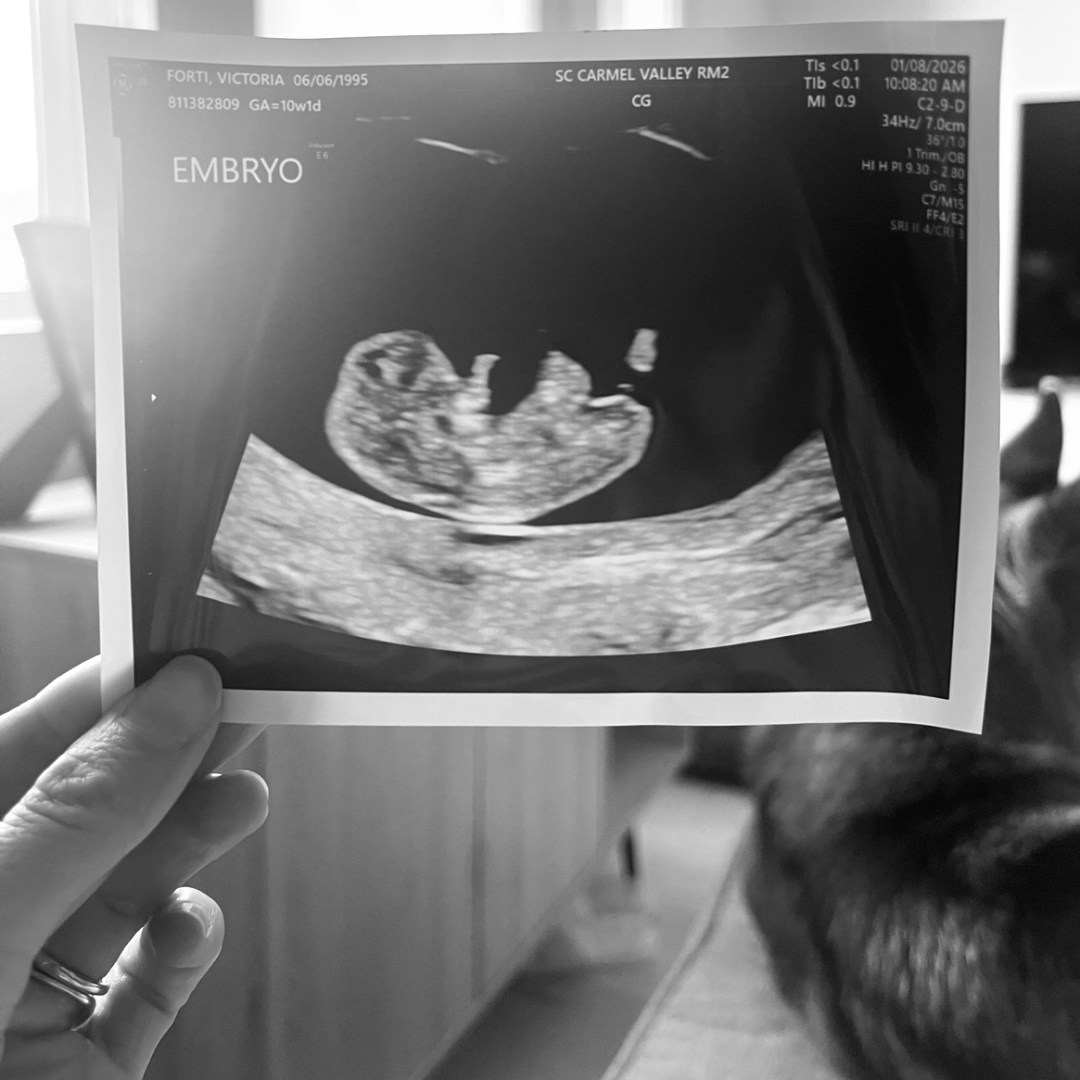 Photo shared by Victoria for their Babylist baby registry.