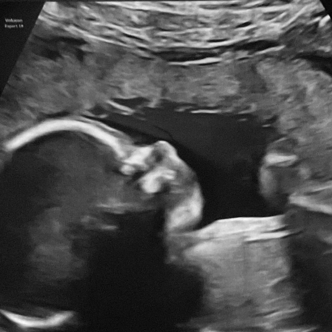 Photo shared by Cassidy for their Babylist baby registry.
