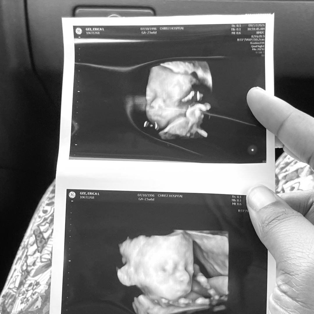 Photo shared by Erica for their Babylist baby registry.