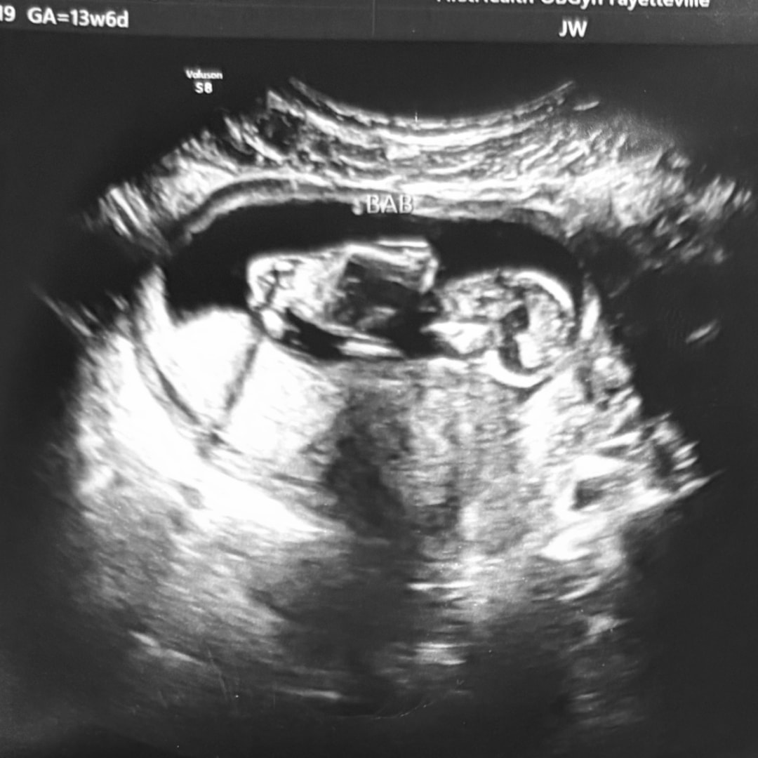 Photo shared by Isabelle for their Babylist baby registry.