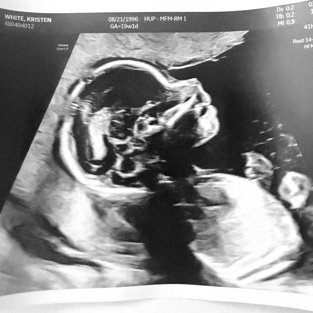 Photo shared by Kristen for their Babylist baby registry.