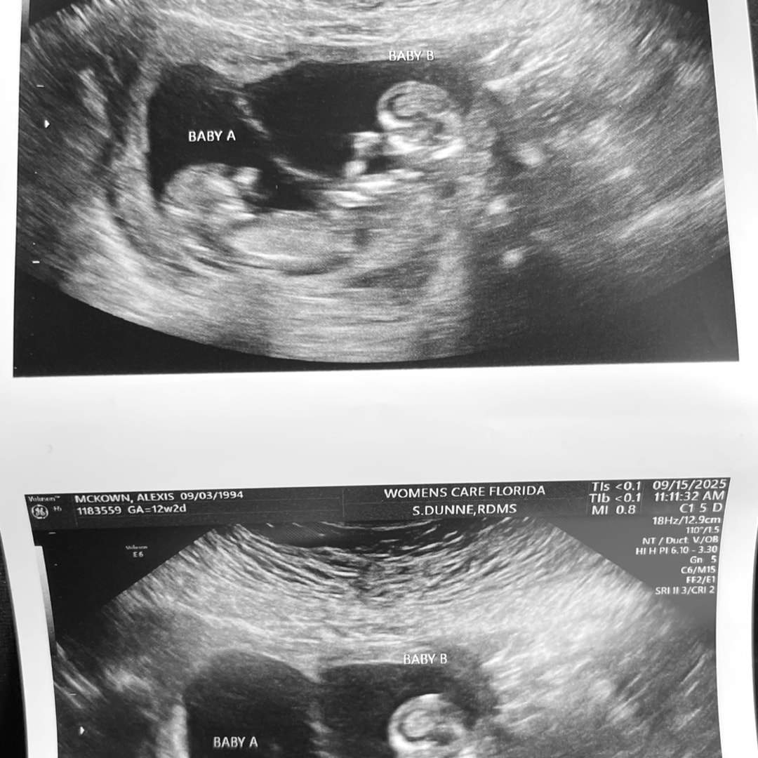 Photo shared by Alexis for their Babylist baby registry.