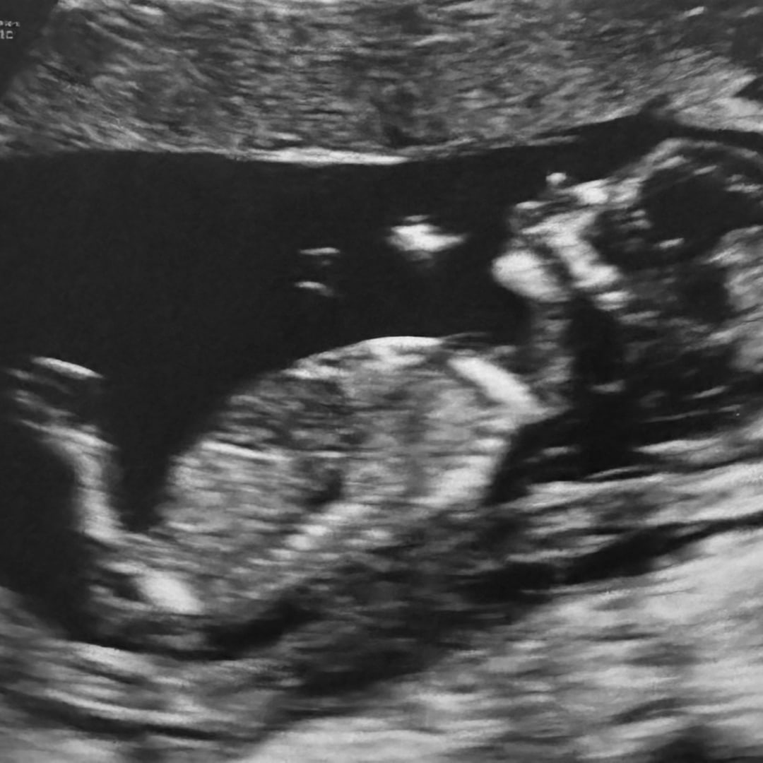 Photo shared by Katie for their Babylist baby registry.