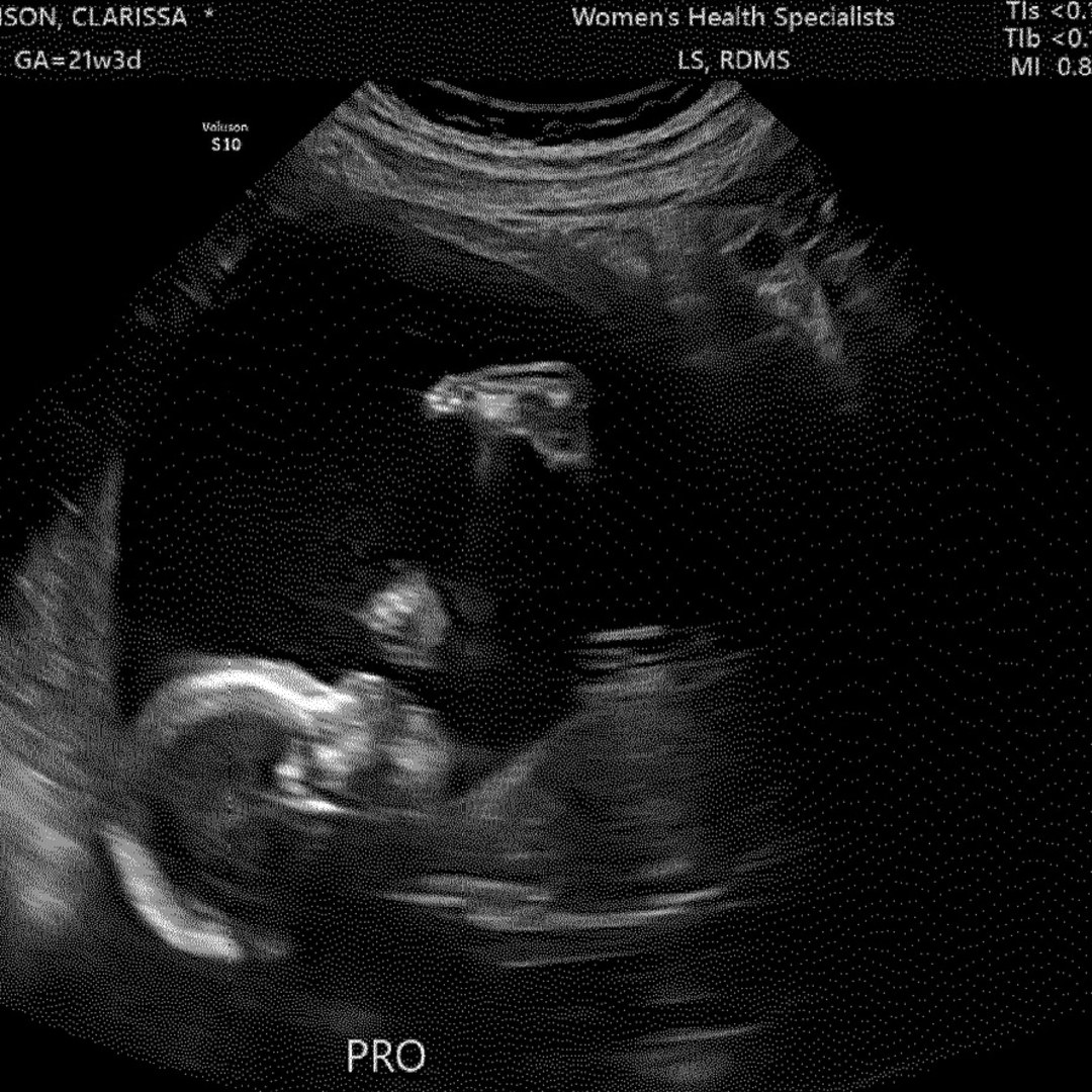 Photo shared by Clarissa for their Babylist baby registry.