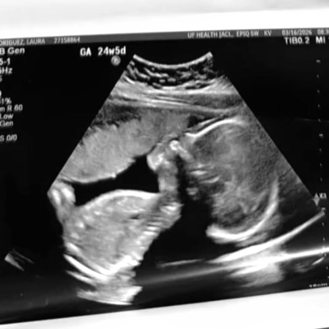 Photo shared by Laura for their Babylist baby registry.