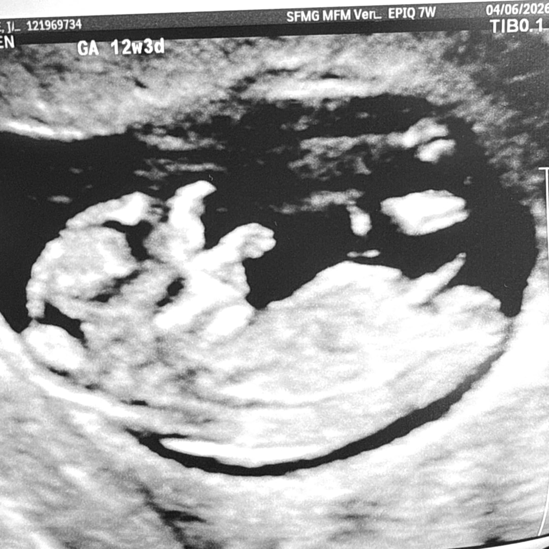 Photo shared by Janise for their Babylist baby registry.