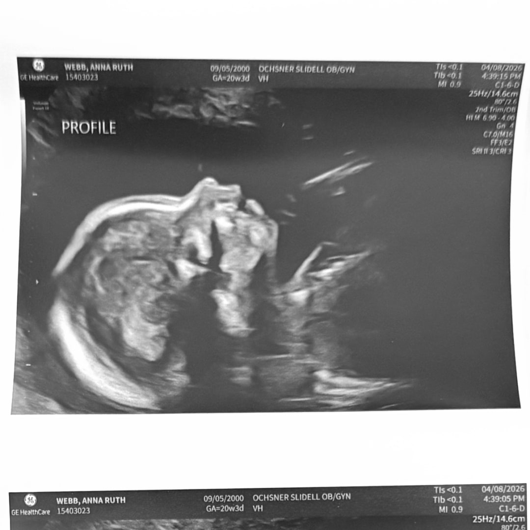 Photo shared by Anna for their Babylist baby registry.