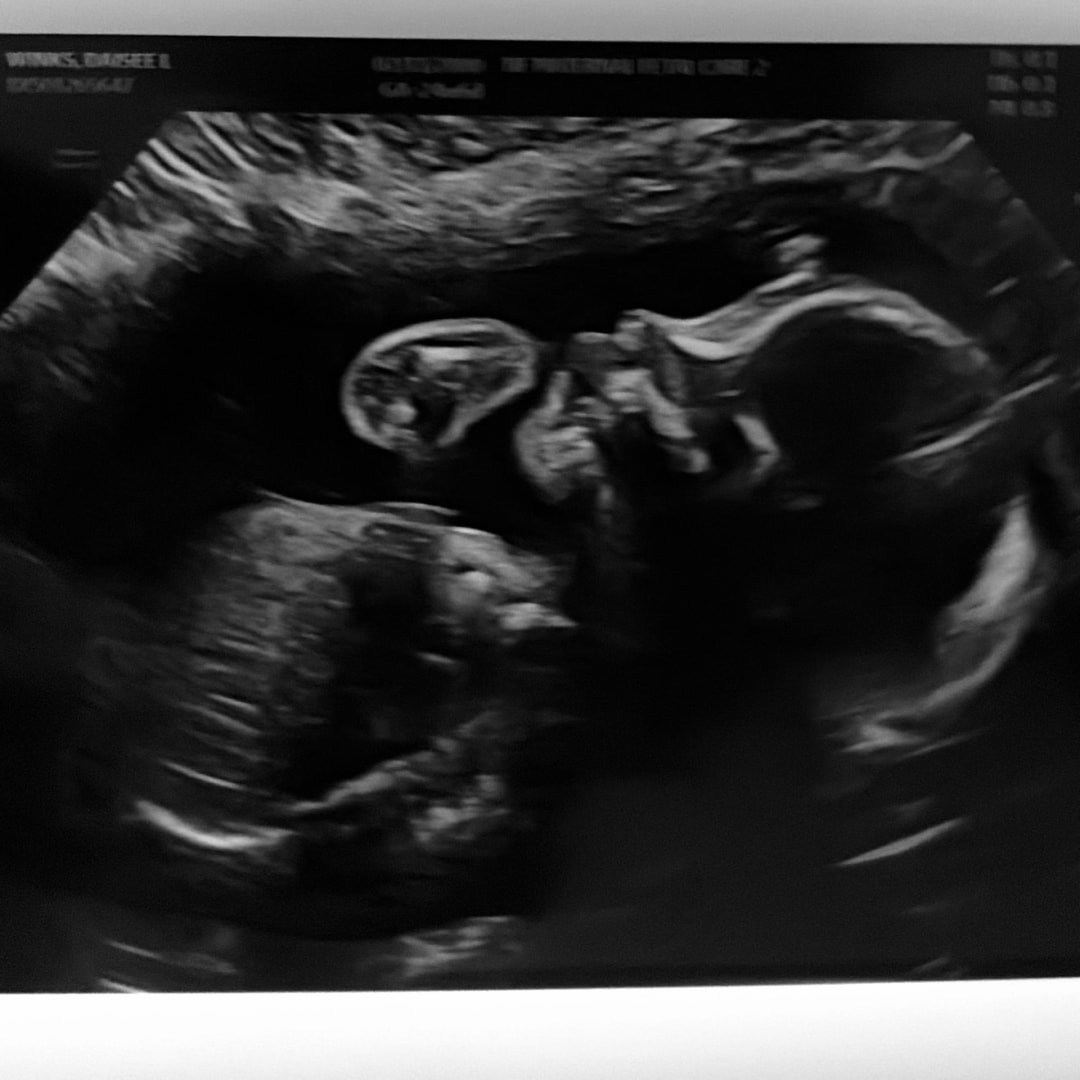 Photo shared by Daisee for their Babylist baby registry.