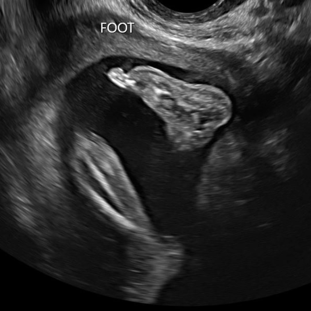 Photo shared by Gracie for their Babylist baby registry.