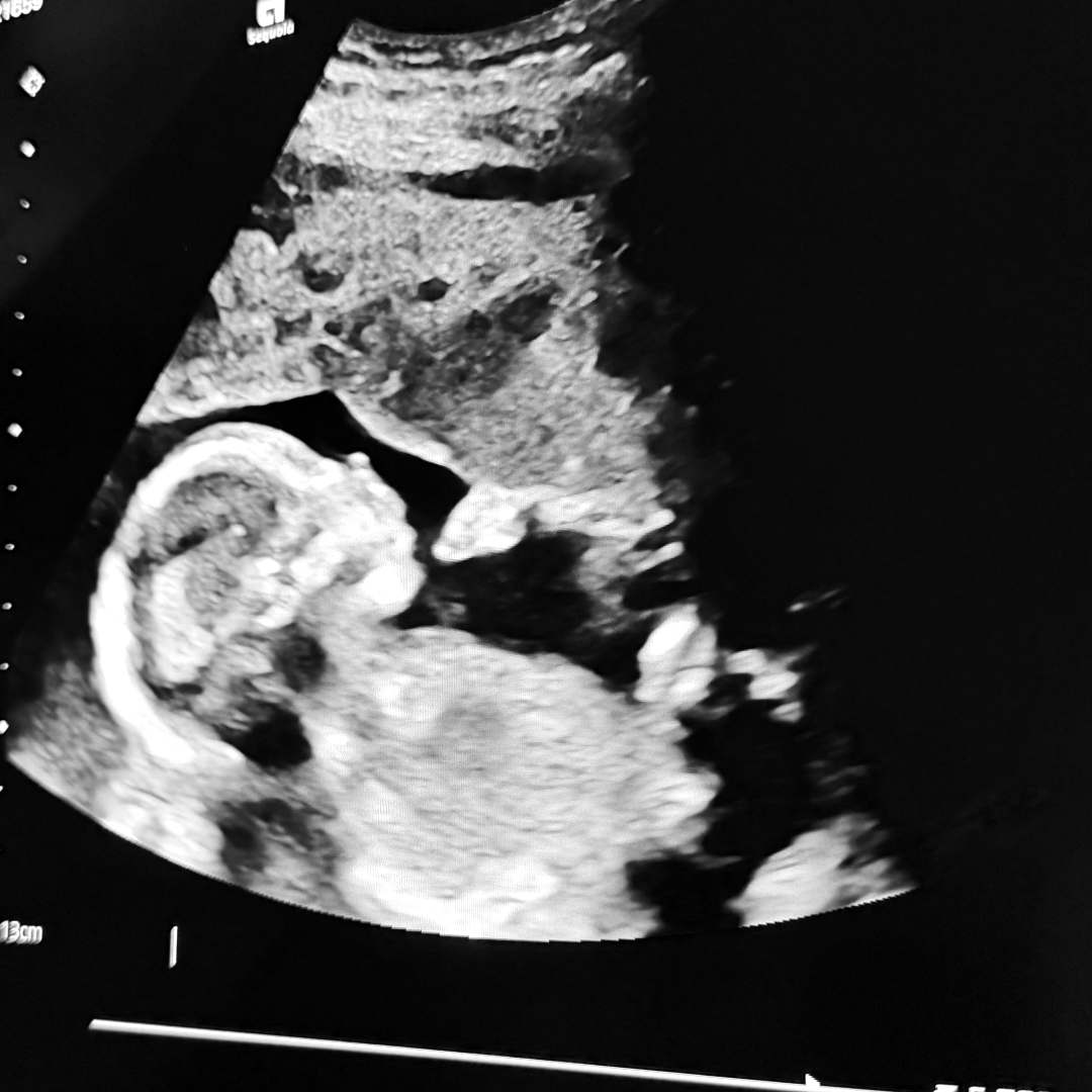 Photo shared by Alex for their Babylist baby registry.