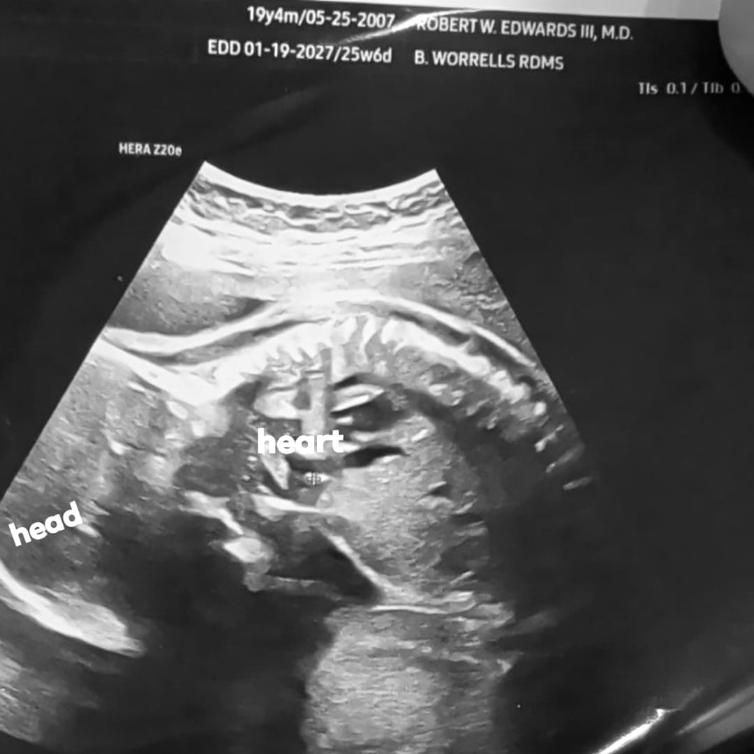 Photo shared by Ashelynn for their Babylist baby registry.