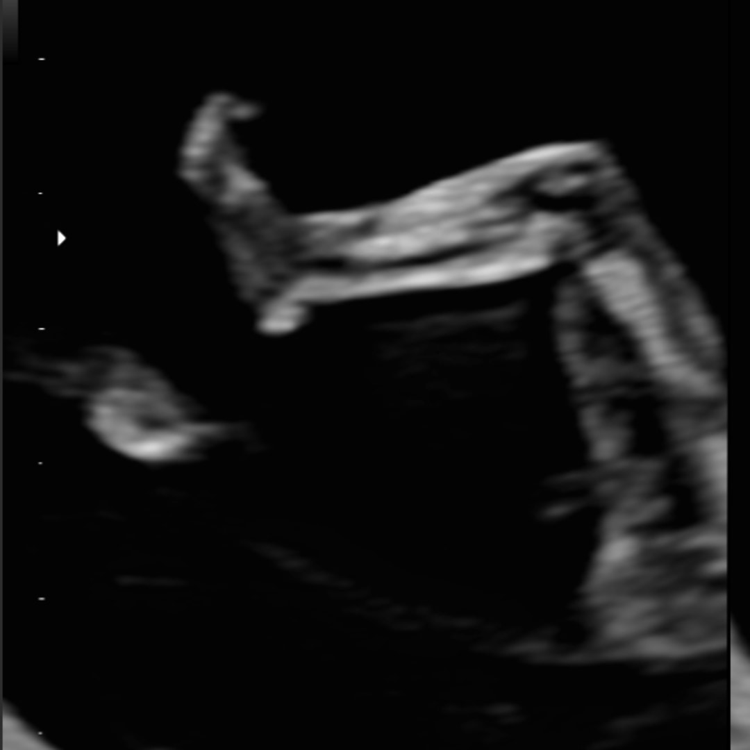 Photo shared by Aaliyah for their Babylist baby registry.