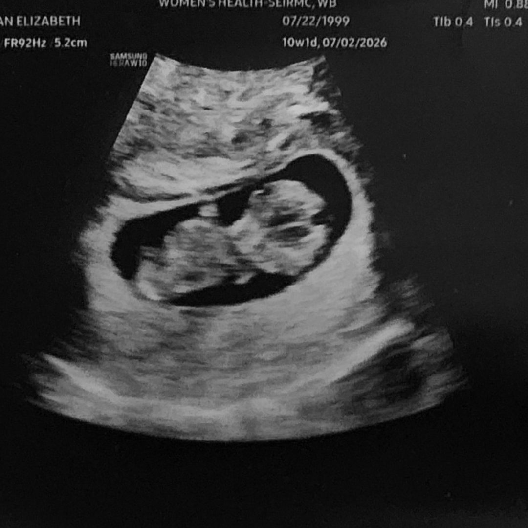 Photo shared by Megan for their Babylist baby registry.