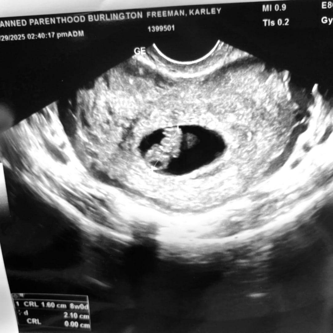 Photo shared by Karley for their Babylist baby registry.
