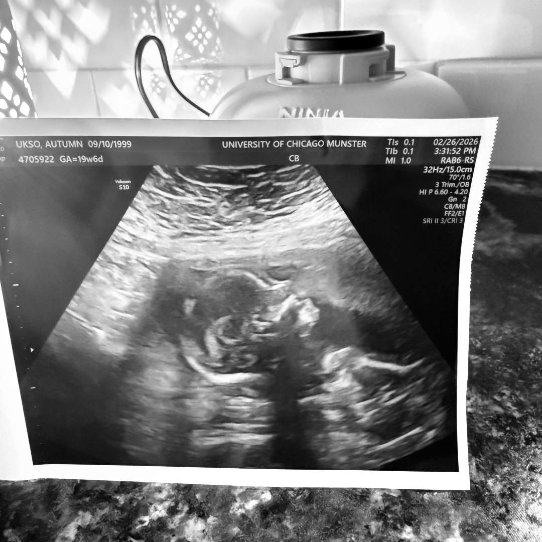 Photo shared by Autumn for their Babylist baby registry.