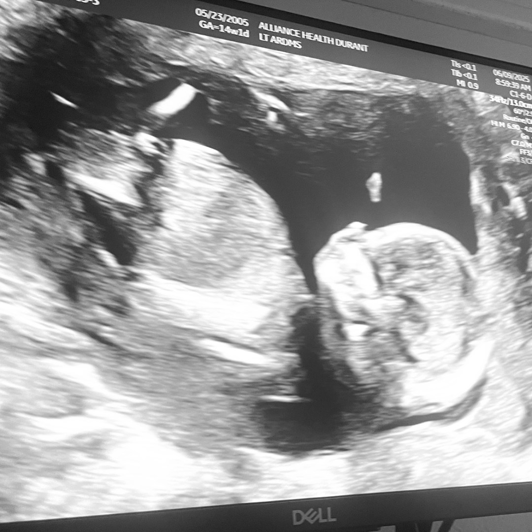 Photo shared by Kaitlyn for their Babylist baby registry.