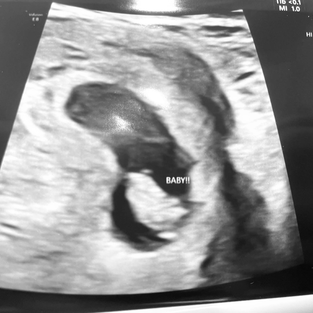 Photo shared by Elizabeth for their Babylist baby registry.