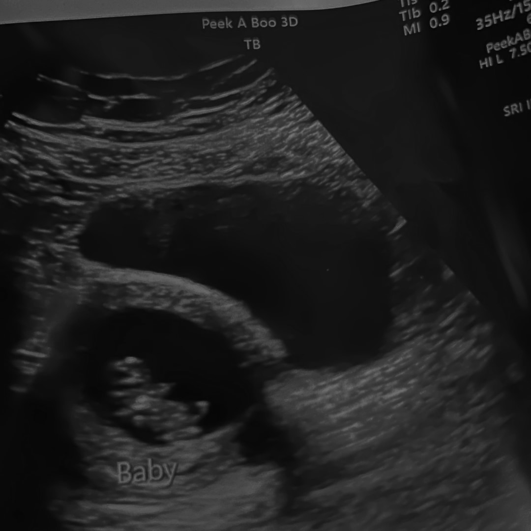 Photo shared by Jamie for their Babylist baby registry.