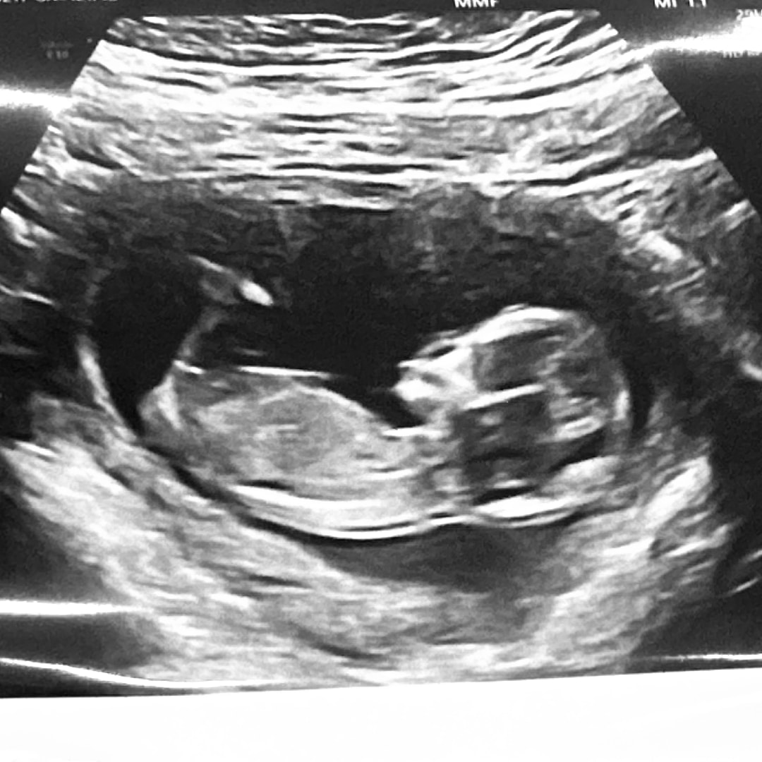 Photo shared by Daisy for their Babylist baby registry.