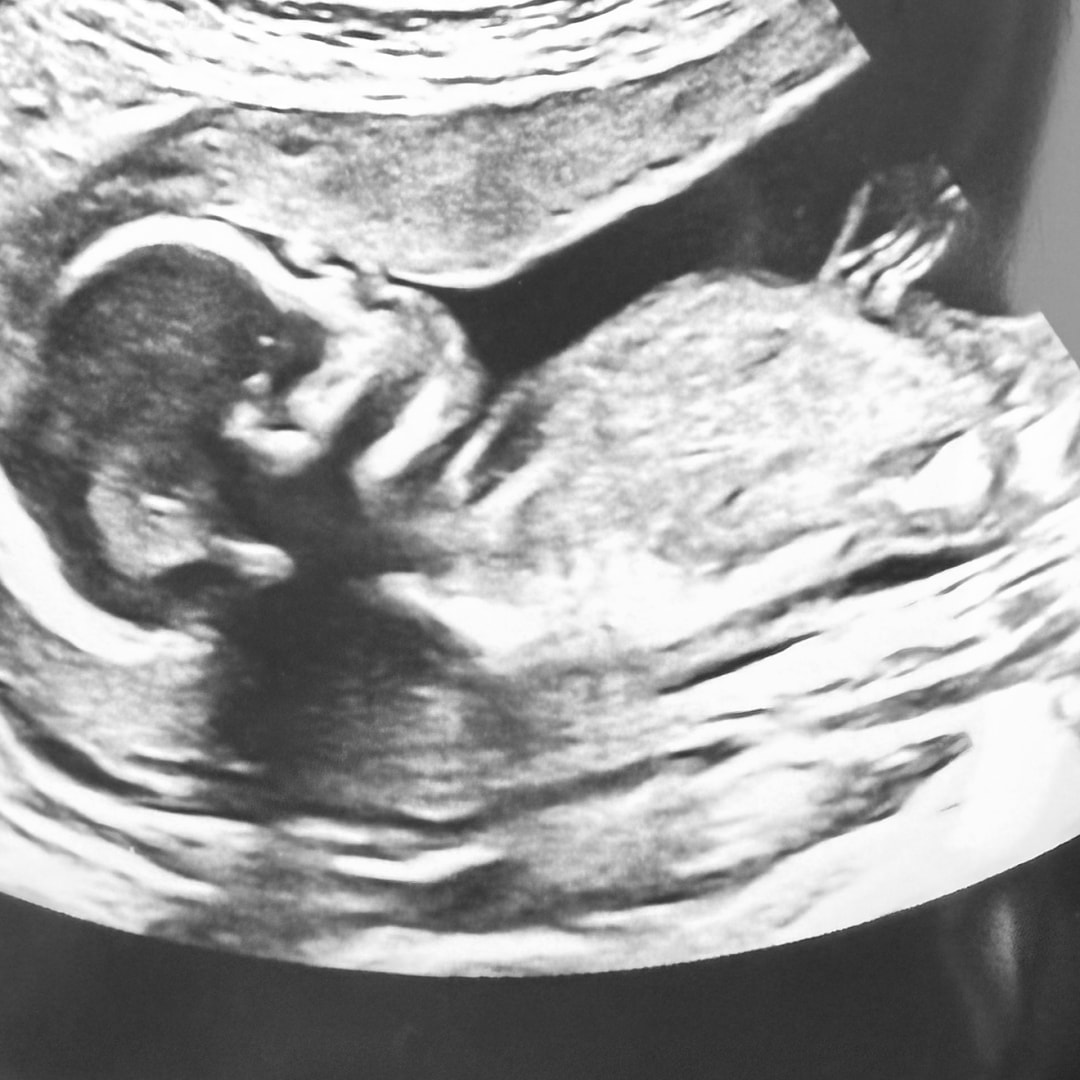 Photo shared by Shirley Ann for their Babylist baby registry.