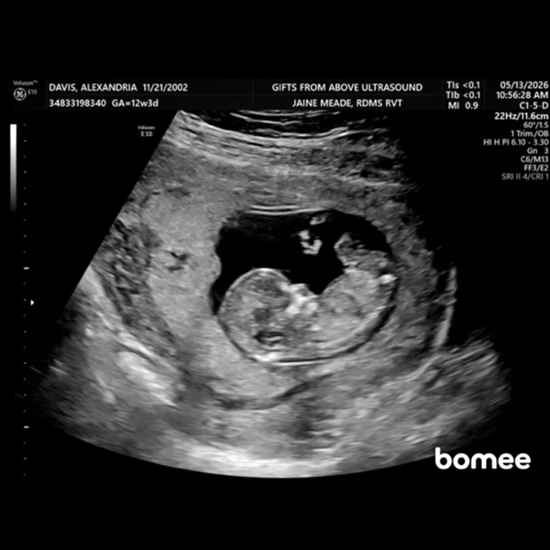 Photo shared by Alexandria for their Babylist baby registry.