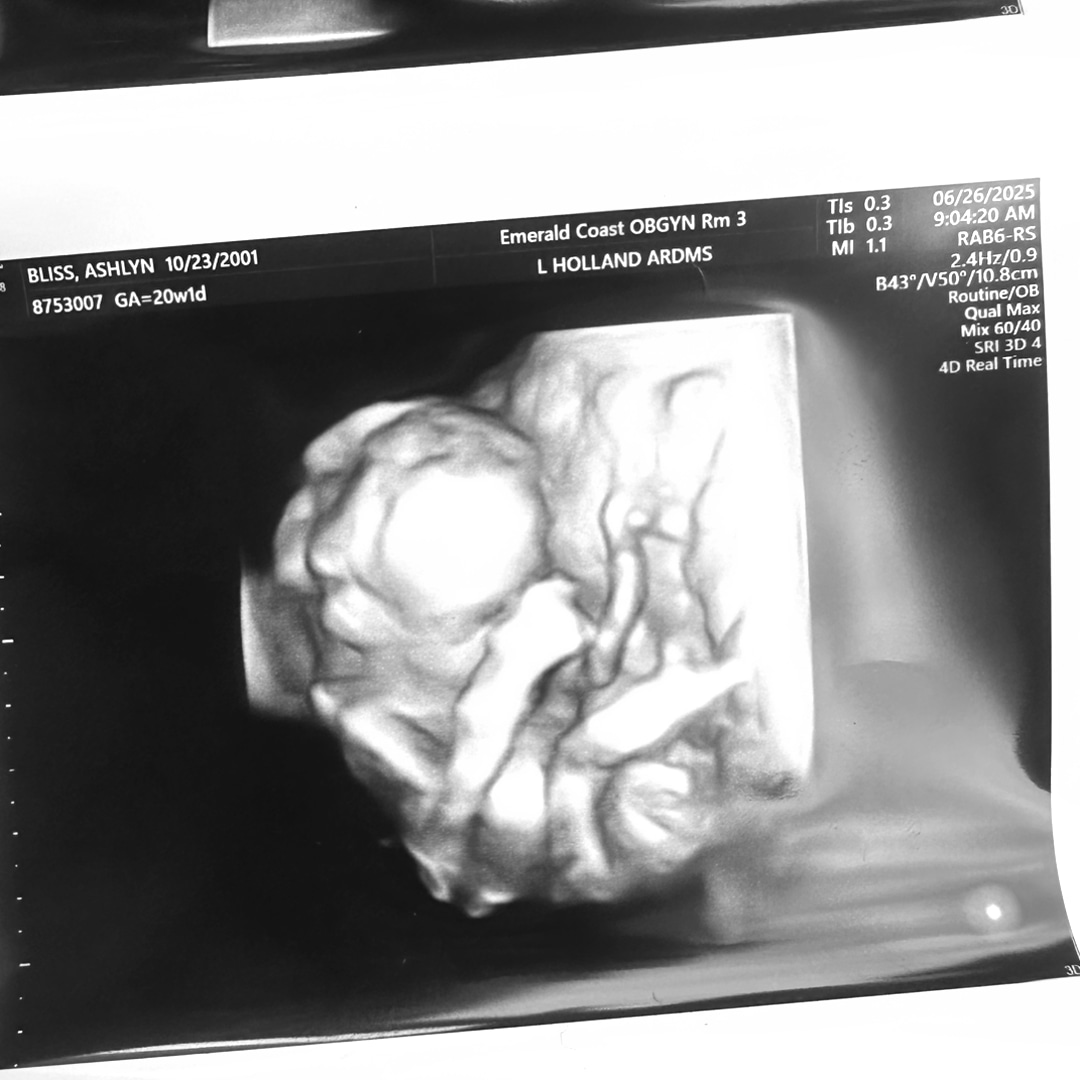 Photo shared by Ashlyn for their Babylist baby registry.
