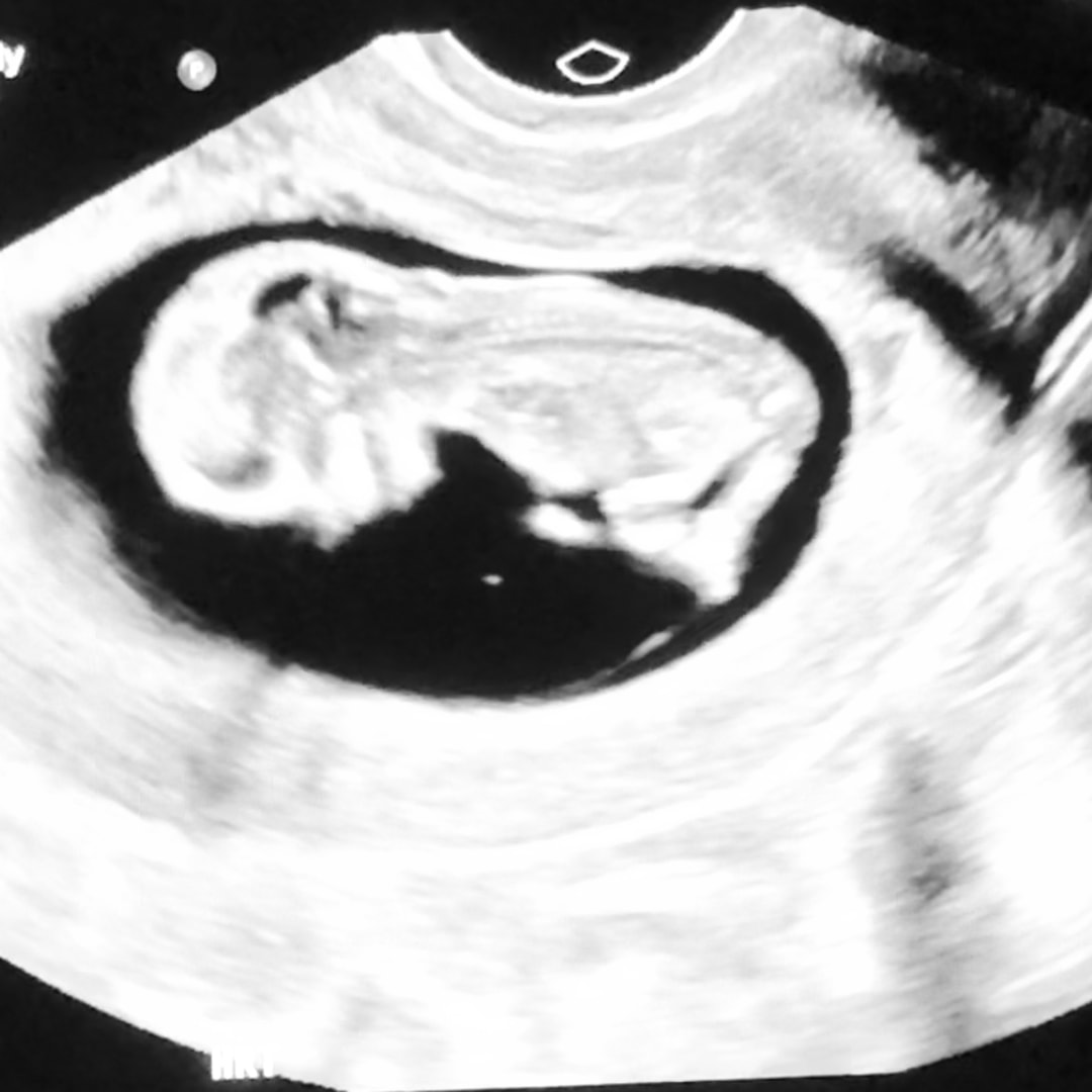 Photo shared by Coralys for their Babylist baby registry.