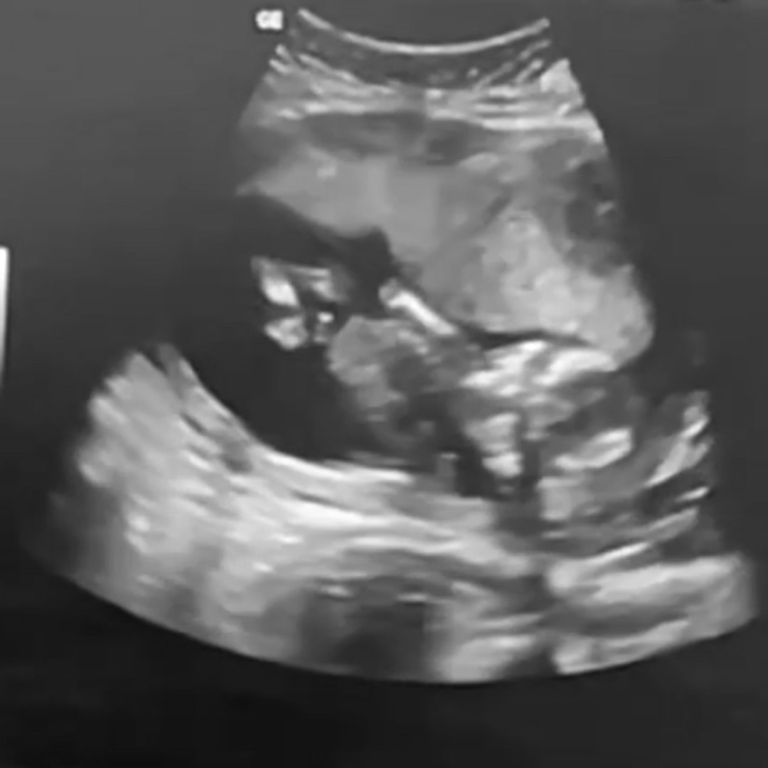 Photo shared by Brittany for their Babylist baby registry.