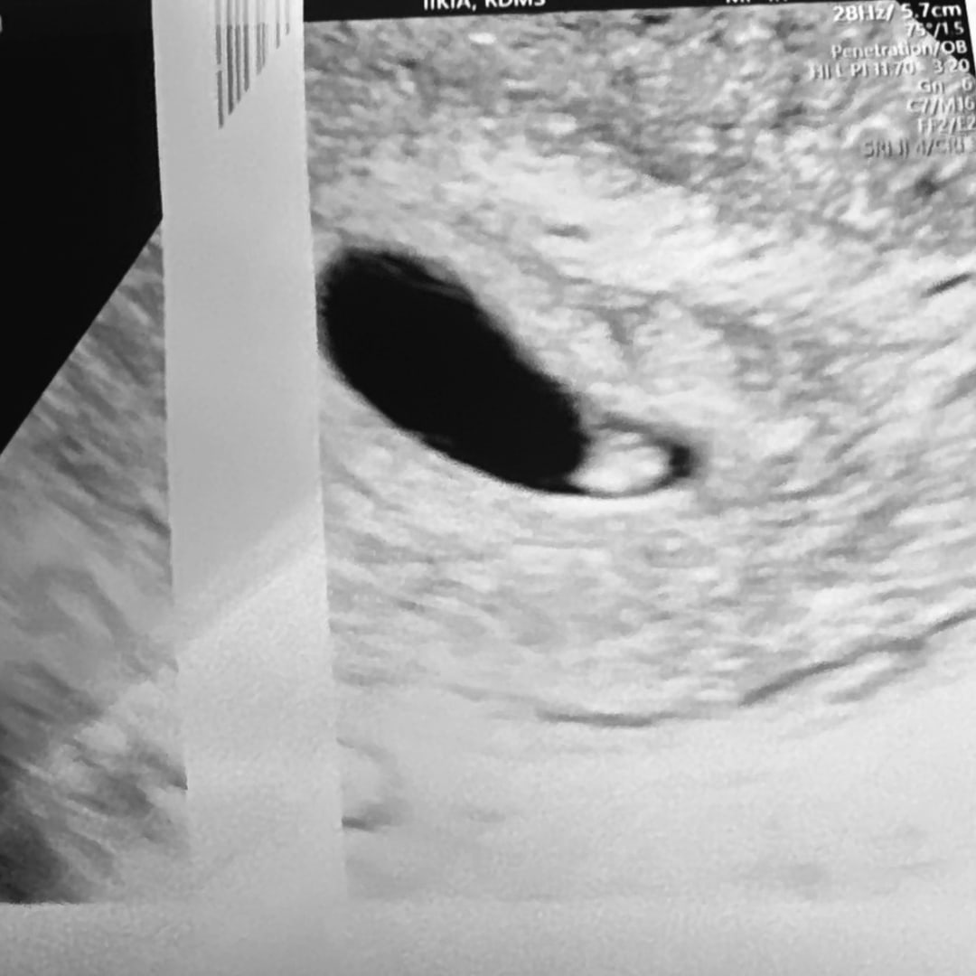 Photo shared by Coralys for their Babylist baby registry.