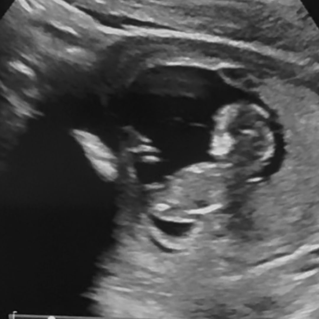 Photo shared by Sophia for their Babylist baby registry.