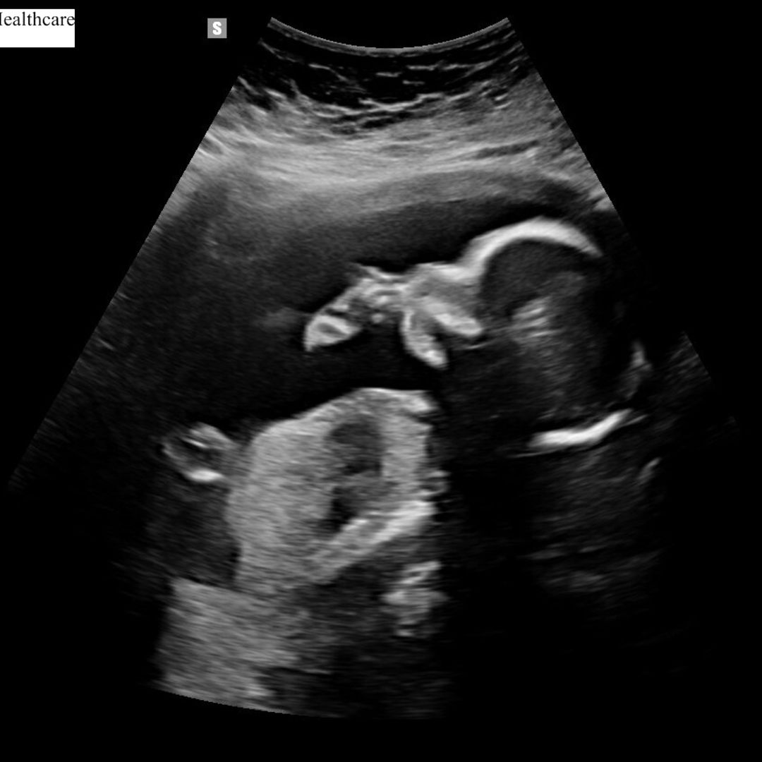 Photo shared by Brittany for their Babylist baby registry.