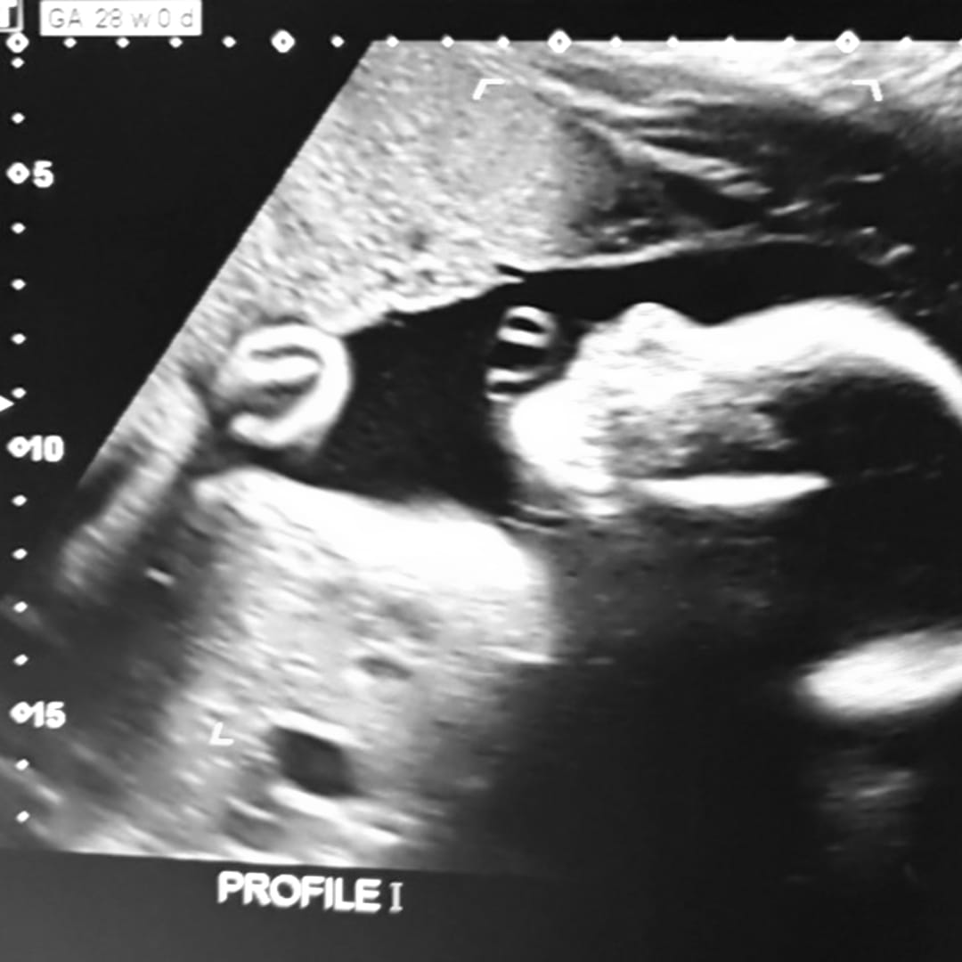 Photo shared by Alexis for their Babylist baby registry.