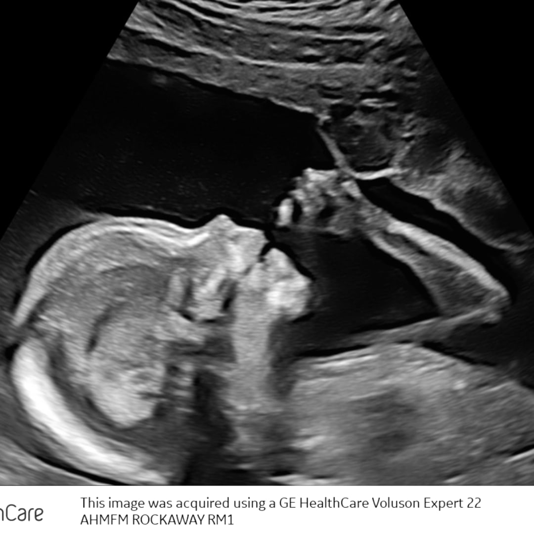 Photo shared by Carly for their Babylist baby registry.