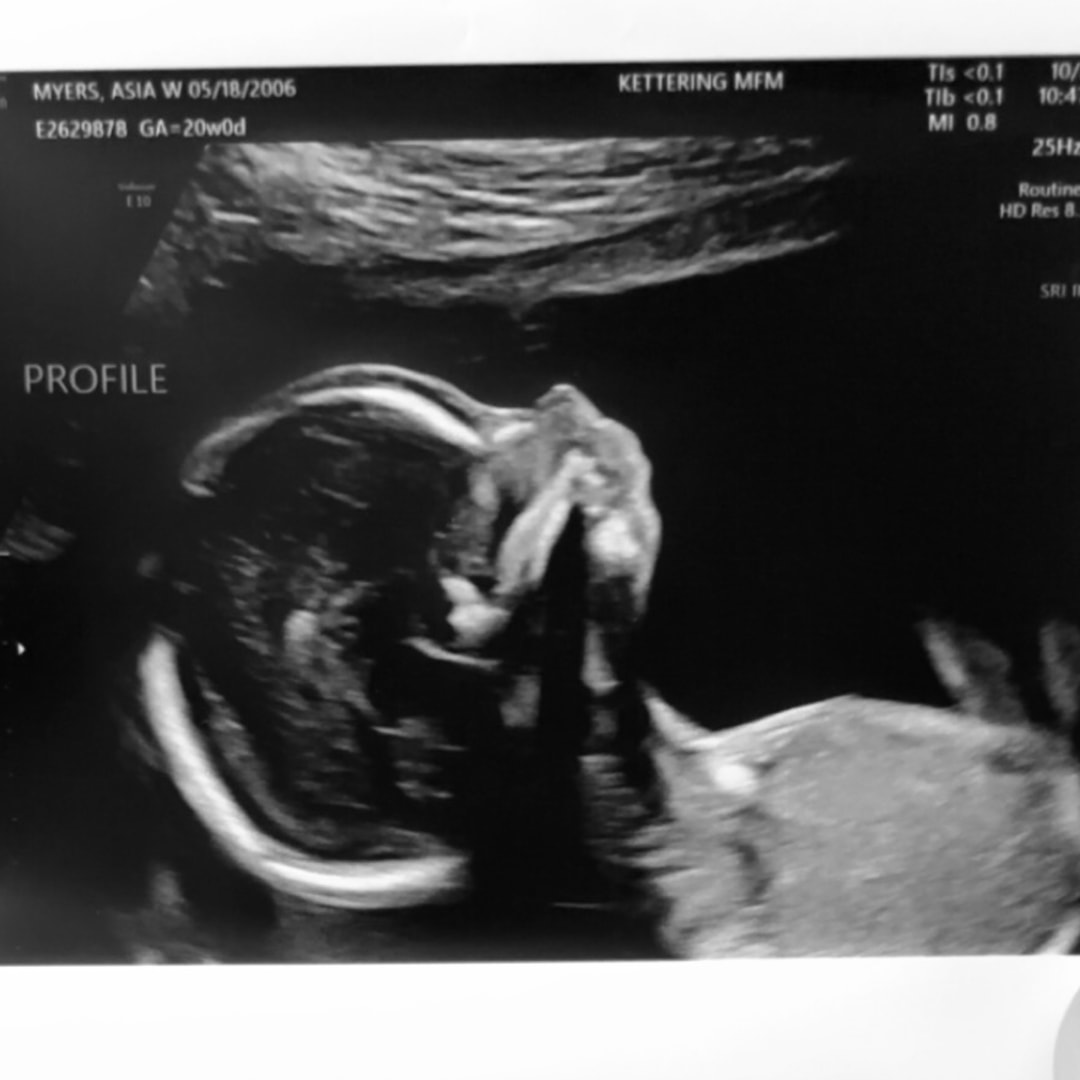 Photo shared by Asia for their Babylist baby registry.