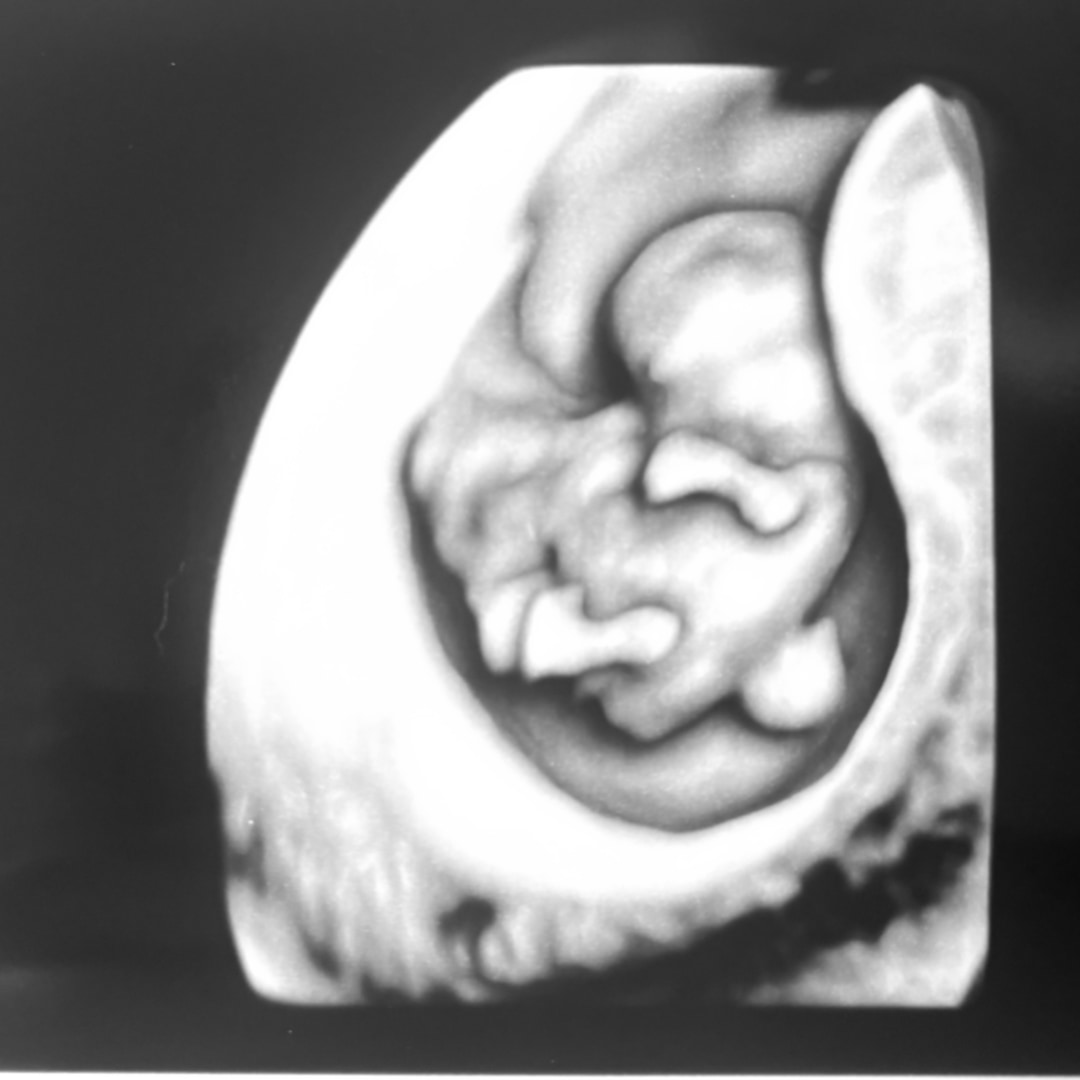 Photo shared by Lauren for their Babylist baby registry.