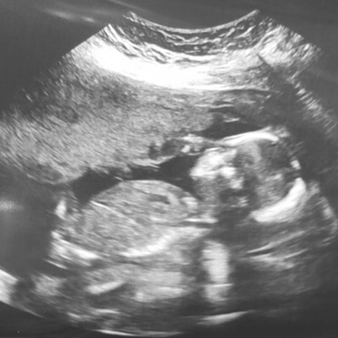 Photo shared by Catty & Andrew for their Babylist baby registry.