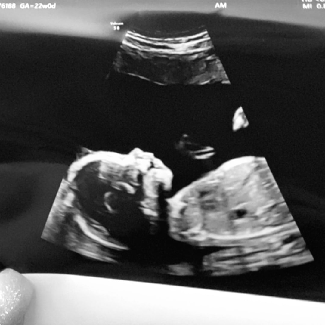 Photo shared by Brooke for their Babylist baby registry.