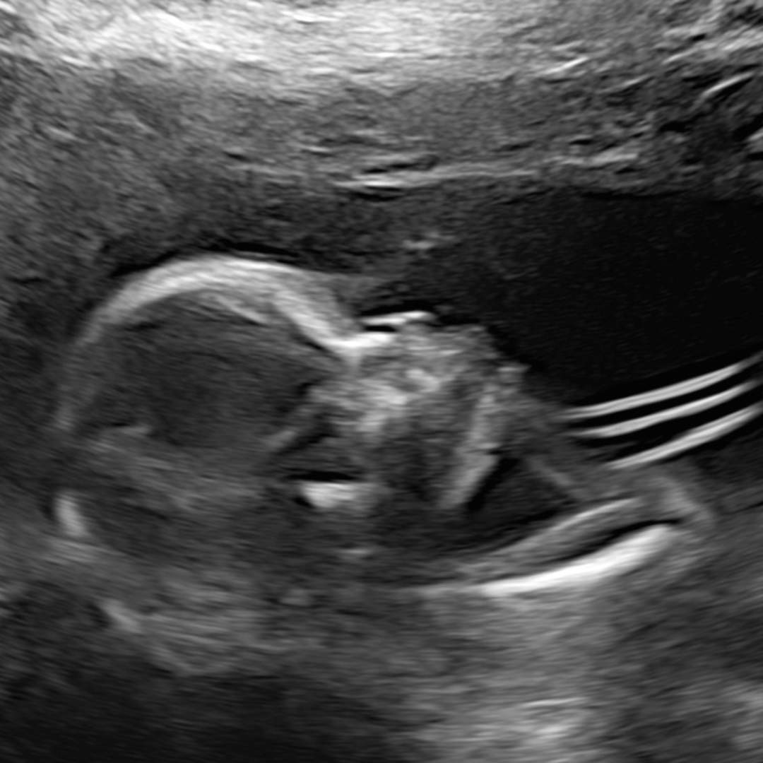 Photo shared by Suzan for their Babylist baby registry.