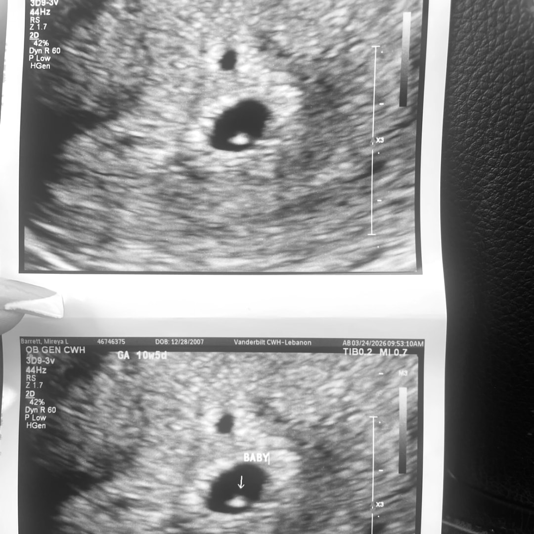 Photo shared by Andres for their Babylist baby registry.