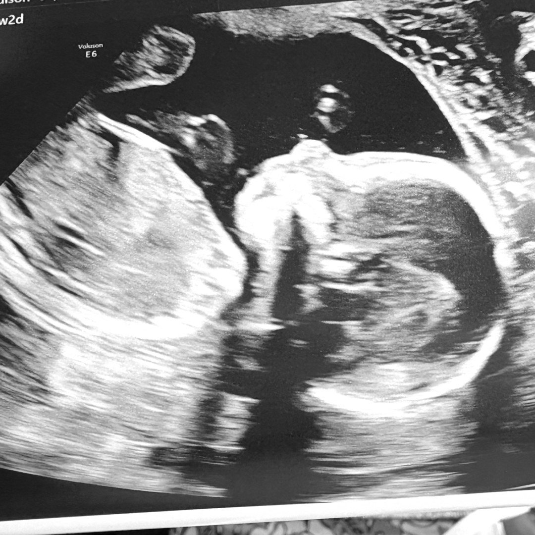 Photo shared by Madison for their Babylist baby registry.