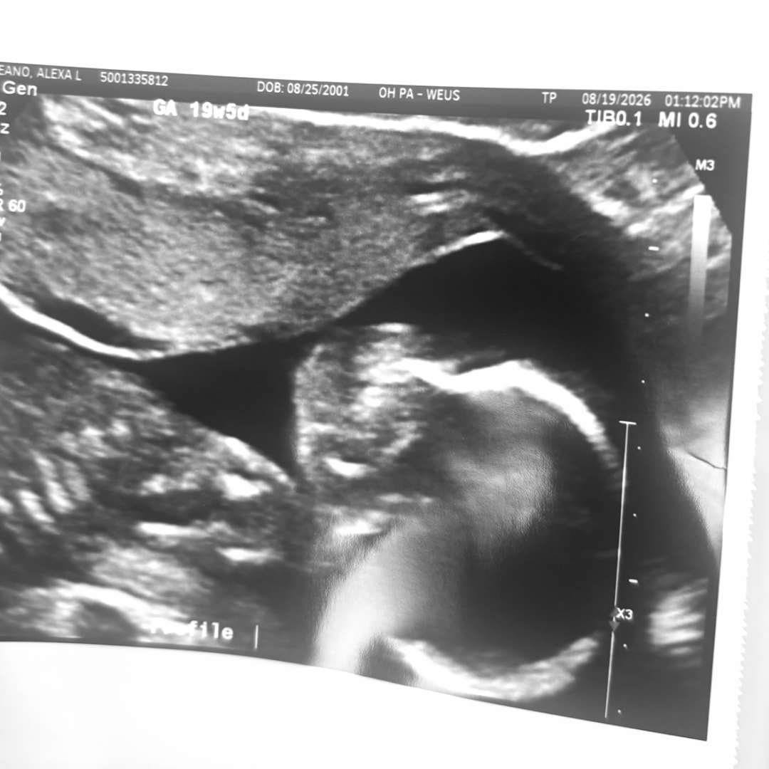 Photo shared by Alexa for their Babylist baby registry.