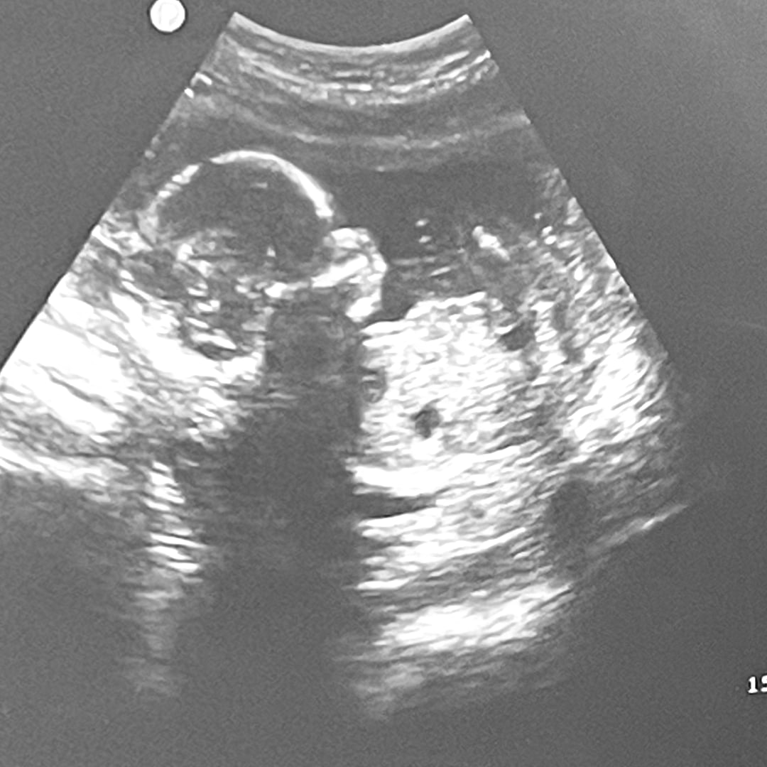 Photo shared by Gina for their Babylist baby registry.