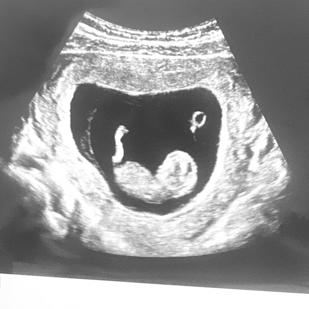 Photo shared by Shell for their Babylist baby registry.