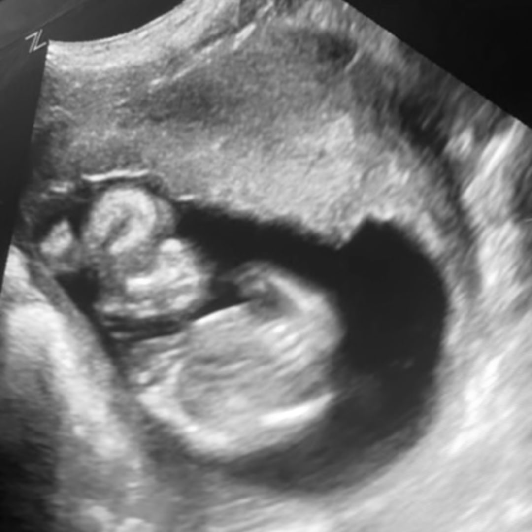 Photo shared by Katie for their Babylist baby registry.